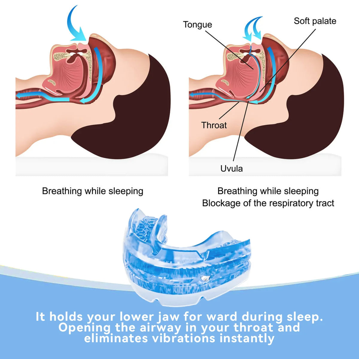 Adjustable Anti Snore Mouthpiece BPA-Free Snoring Mouth Guard