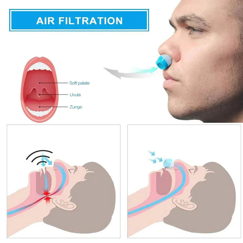 Micro-CPAP Device for Quiet, Comfortable, and Easy Anti-Snoring Relief