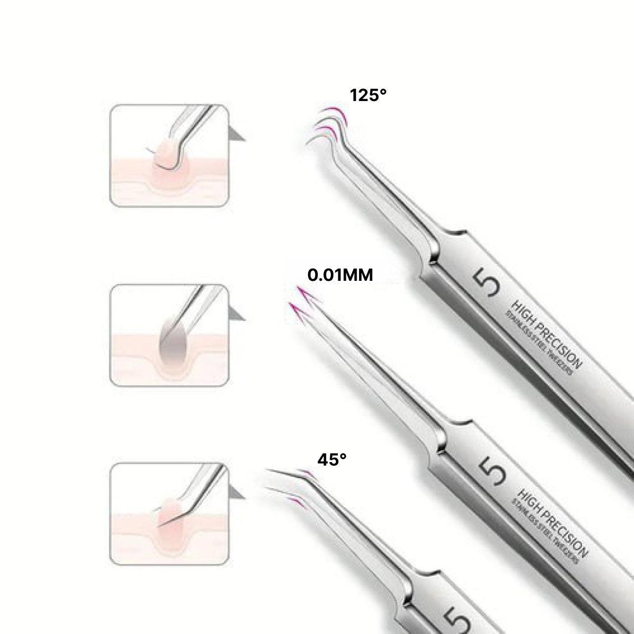 Stainless Steel Blackhead Remover with Precision Tips