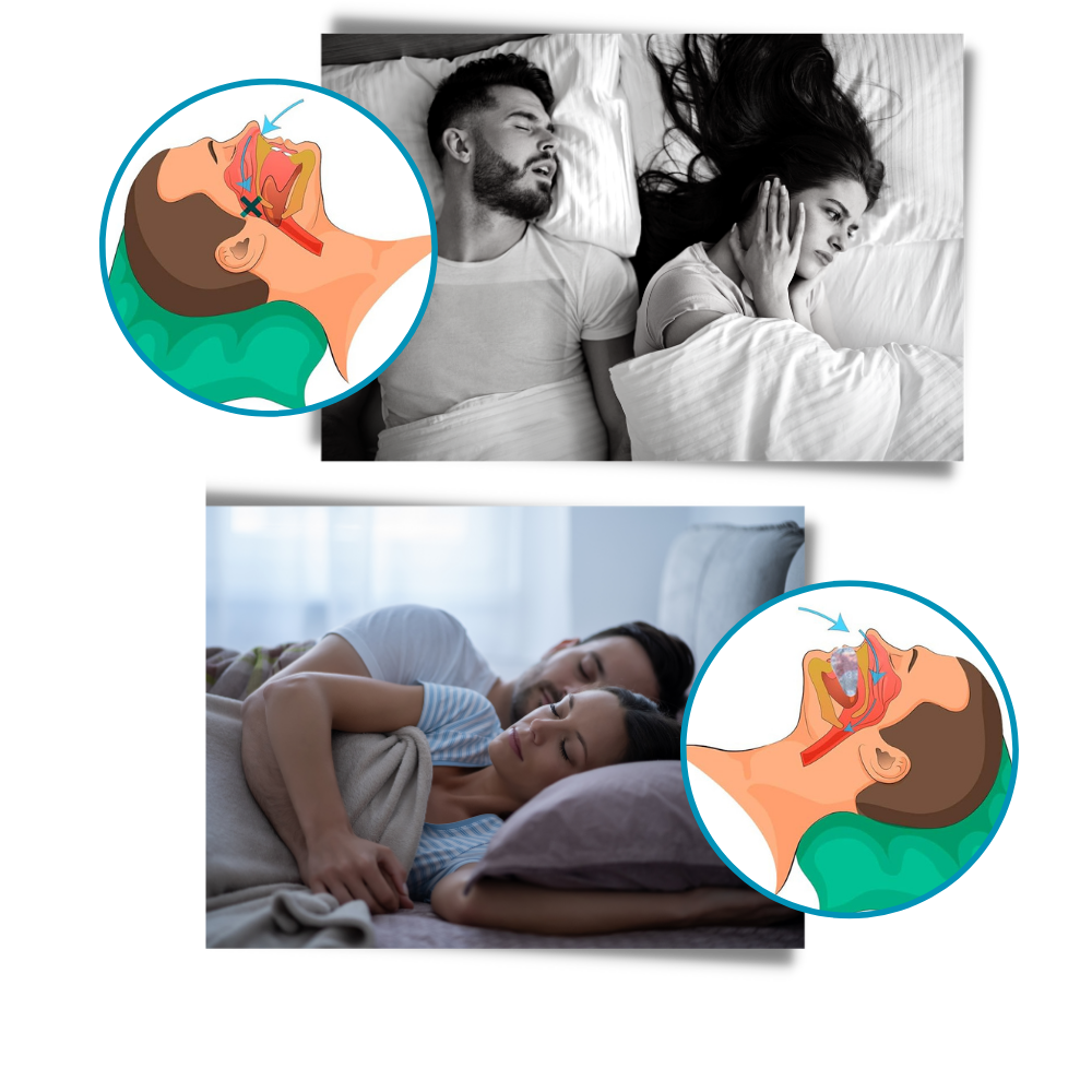 Advanced Comfortable Anti-Snoring Mouthpiece for Instant Snore Relief