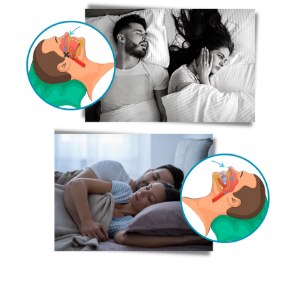 Advanced Comfortable Anti-Snoring Mouthpiece for Instant Snore Relief