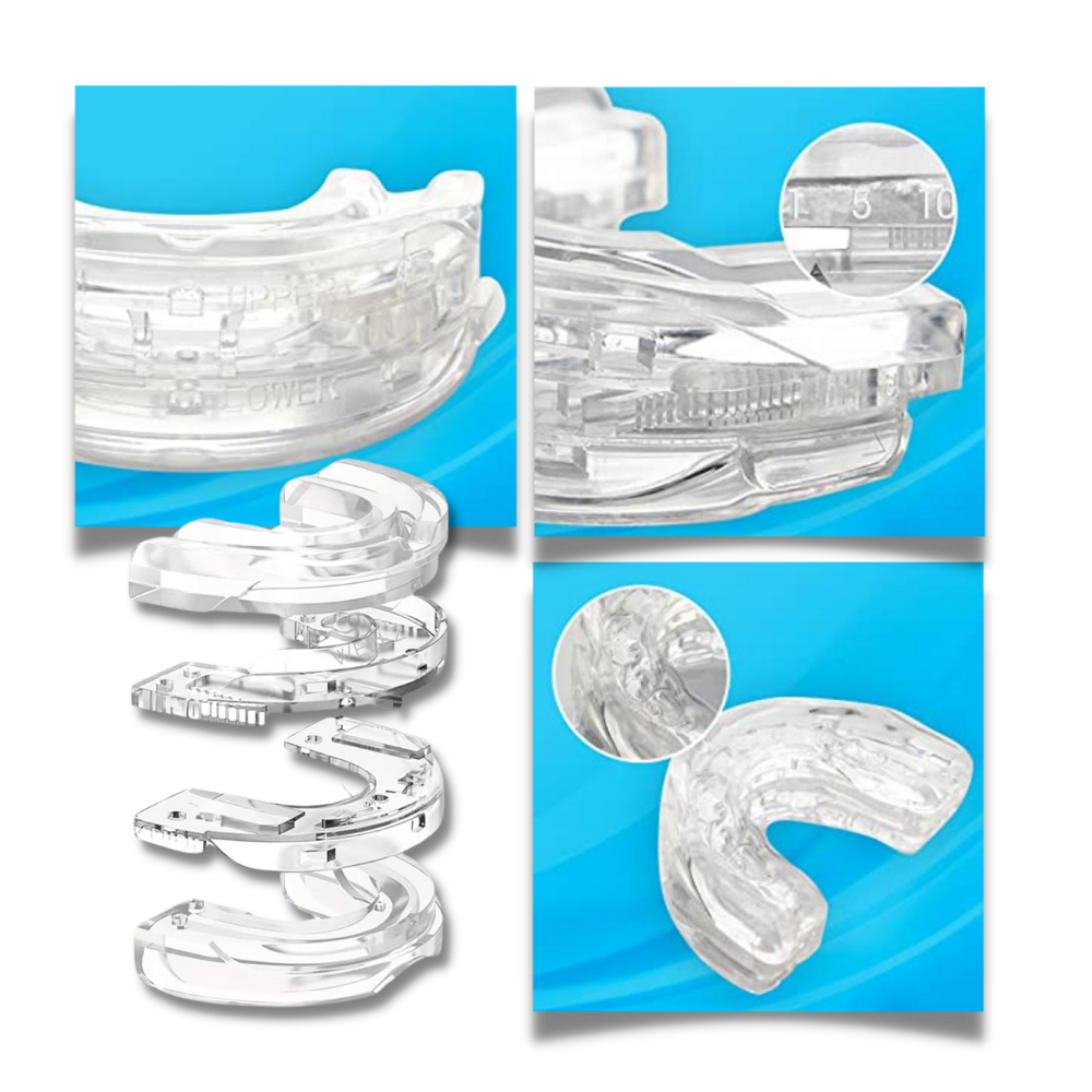 Advanced Comfortable Anti-Snoring Mouthpiece for Instant Snore Relief