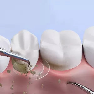 LED Electric Dental Cleaner with Ergonomic Handle