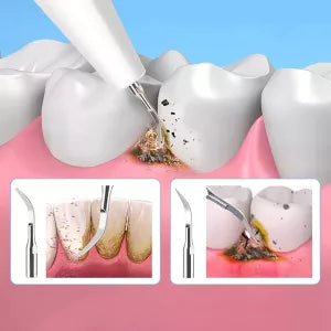 LED Electric Dental Cleaner with Ergonomic Handle