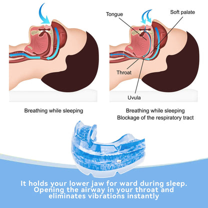 Adjustable Anti Snore Mouthpiece BPA-Free Snoring Mouth Guard
