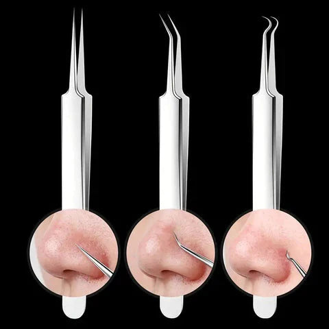 Stainless Steel Blackhead Remover with Precision Tips