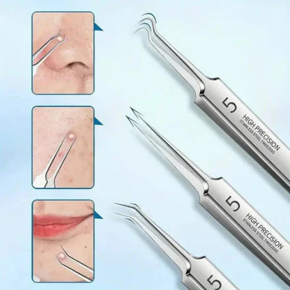 Stainless Steel Blackhead Remover with Precision Tips