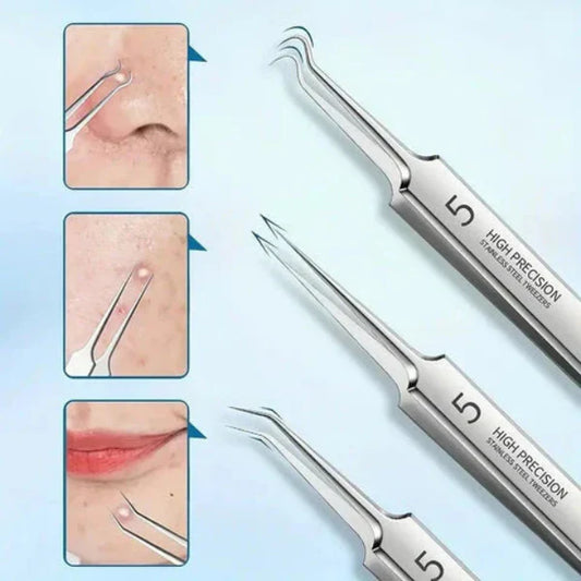 Stainless Steel Blackhead Remover with Precision Tips
